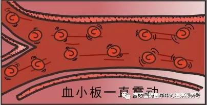 血小板是正常值的三倍？專家提醒小心血栓和出血！
