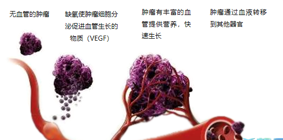 晚期腫瘤為什么會復發(fā)轉移？