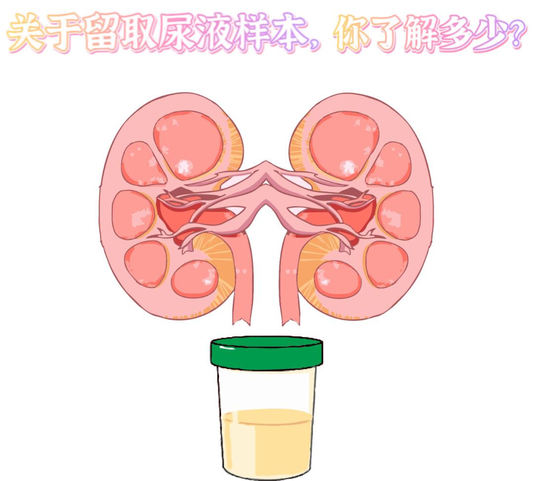 做尿檢，不得不說的注意事項！