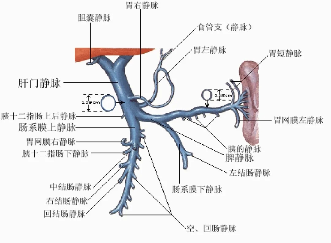 反復(fù)嘔血、黑便怎么辦？TIPS手術(shù)能解決
