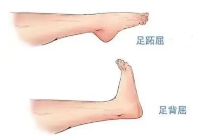 扭胯小連步、動感搖花手……“科目三”雖火，運動損傷也要防！