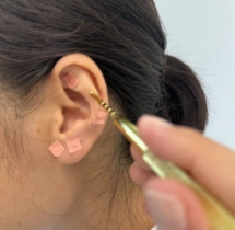 中醫(yī)護(hù)眼 點(diǎn)亮“睛”彩世界！又一波福利來襲