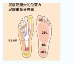 每年新生數(shù)百萬(wàn)足底筋膜炎患者！國(guó)際醫(yī)學(xué)專(zhuān)家提醒：跑步要選擇合適的鞋